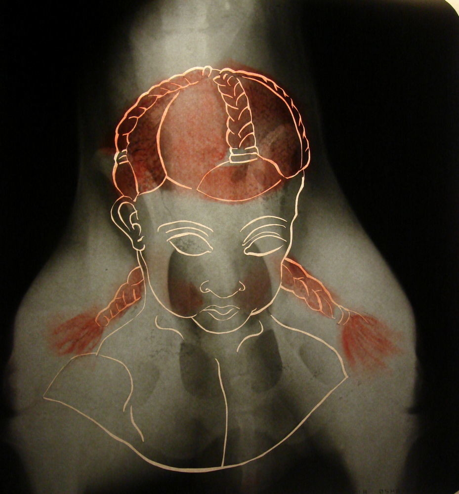 Exhibit image