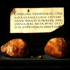 Urinary stones and two shells on a stone slab with label by Anonymous