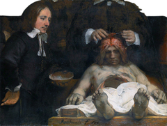 The anatomy lesson of Dr. Joan Deyman by Rembrandt