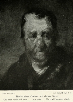 Study of a man with a swollen nose by Rembrandt